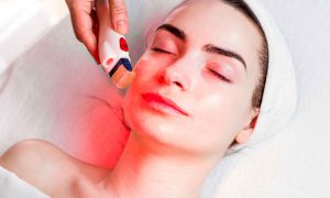 What is Micro-needling Therapy & what insurance do you need?