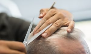 Everything you need to know about hair loss and iron deficiency